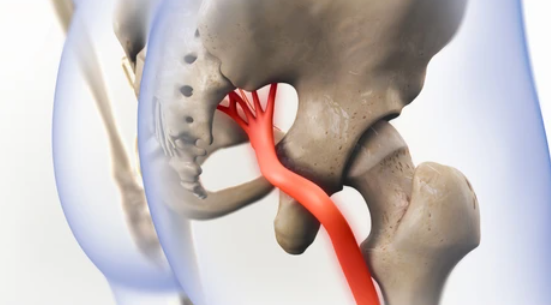 pinched nerve treatment Forest Hills Rehab Queens NY